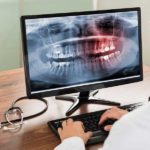 Radiologia Digitale ai denti. Dentista a Como