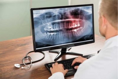 Radiologia Digitale ai denti. Dentista a Como