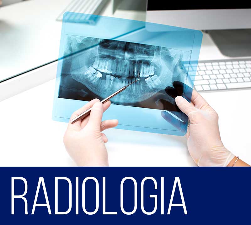 Radiografia dentale a Como - Lombardia - Studio dentistico Pozzoli Radice